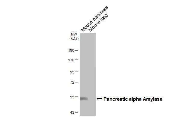 Pancreatic Amylase Beta Antibody - BSA Free