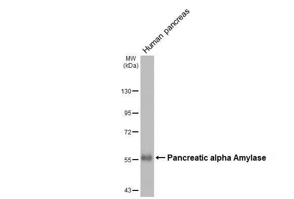 Pancreatic Amylase Beta Antibody - BSA Free