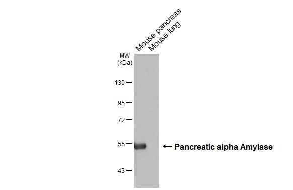 Pancreatic Amylase Beta Antibody - BSA Free