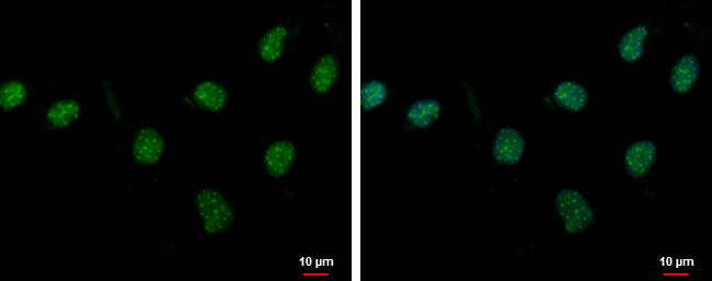 PASD1 Antibody - BSA Free