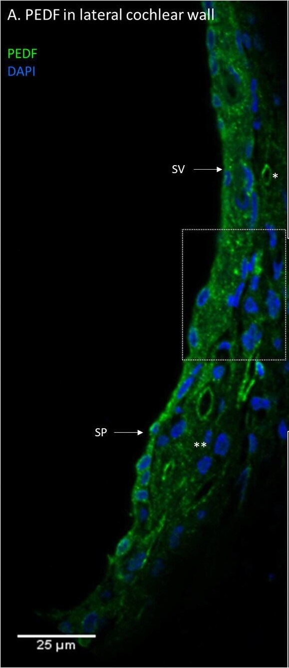 Serpin F1/PEDF Antibody - BSA Free