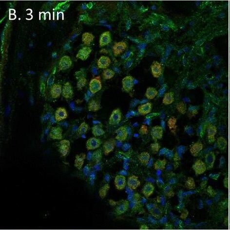 Serpin F1/PEDF Antibody - BSA Free