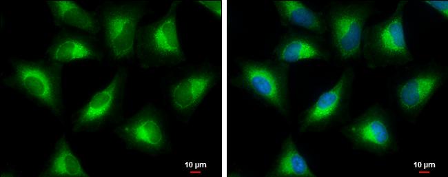 PGLS Antibody