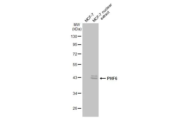 PHF6 Antibody