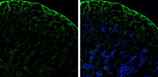 PHGDH Antibody