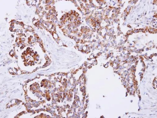 PITRM1 Antibody