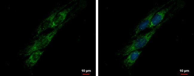 PITRM1 Antibody - BSA Free