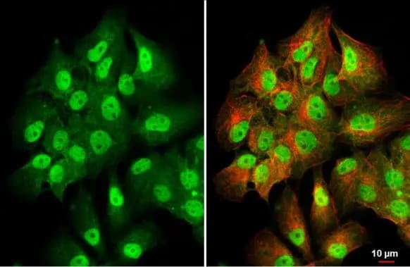 PKC beta Antibody