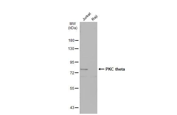 PKC theta Antibody
