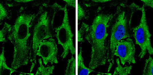 PKM2 Antibody