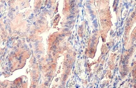 PKM2 Antibody