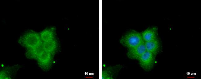 PLA2G4F Antibody - BSA Free