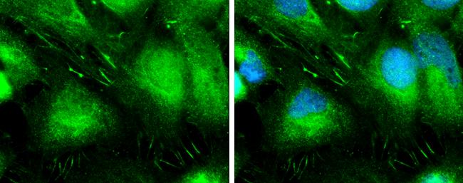 Plastin L Antibody - BSA Free