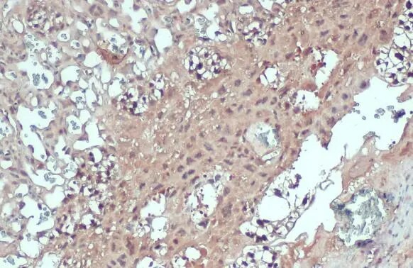 PNMT Antibody