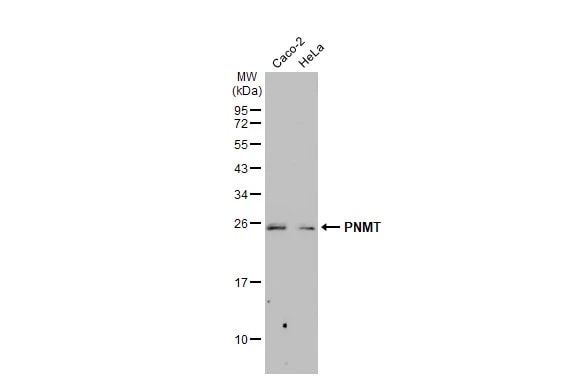 PNMT Antibody