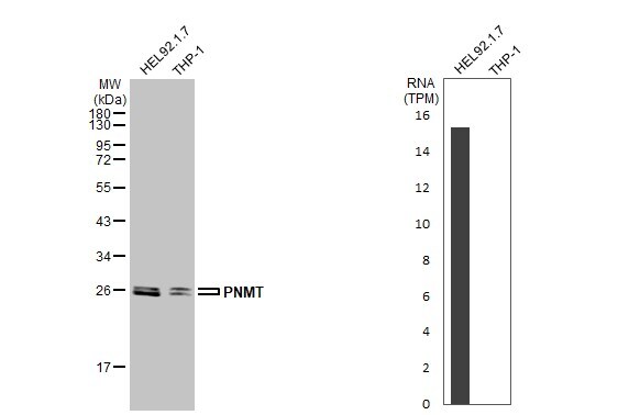 PNMT Antibody - BSA Free