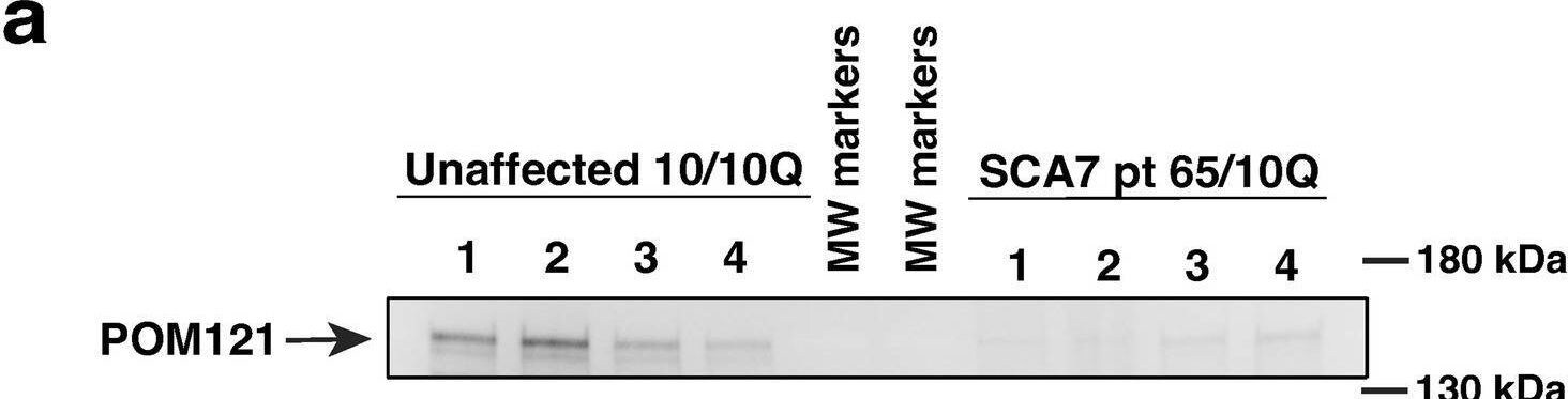 POM121 Antibody