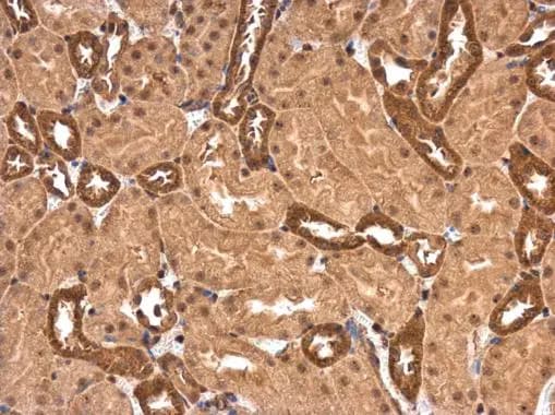 PPP2R1A Antibody