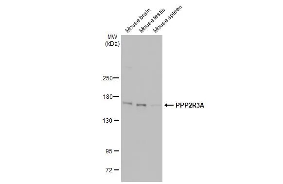 PPP2R3A Antibody