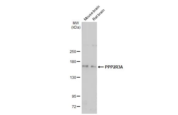 PPP2R3A Antibody