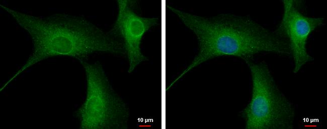 PPP2R3A Antibody
