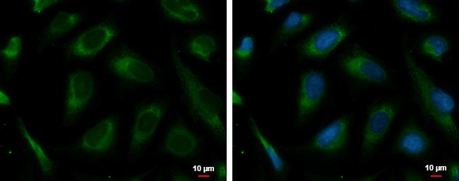PRKCSH Antibody