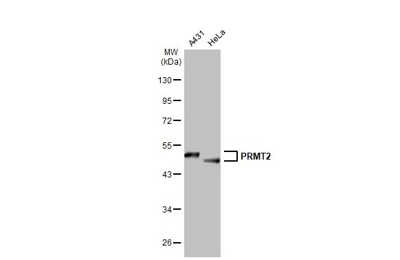 PRMT2 Antibody