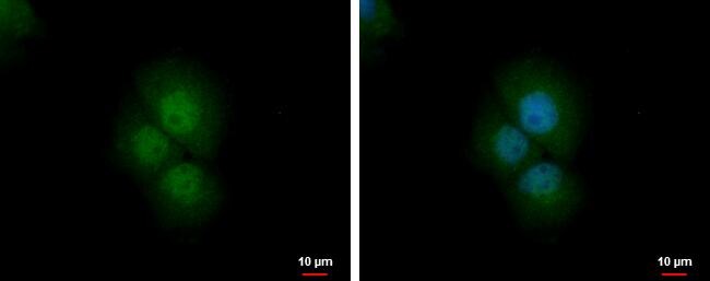 PRMT2 Antibody - BSA Free