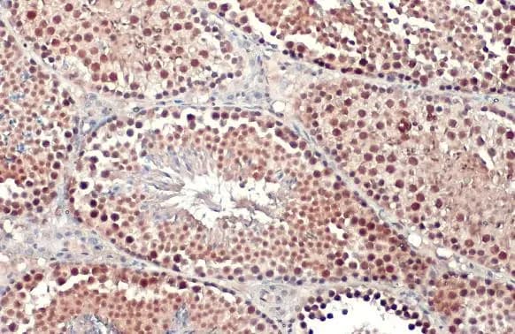 PRMT5 Antibody