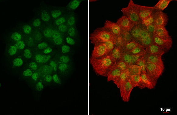 PRMT5 Antibody