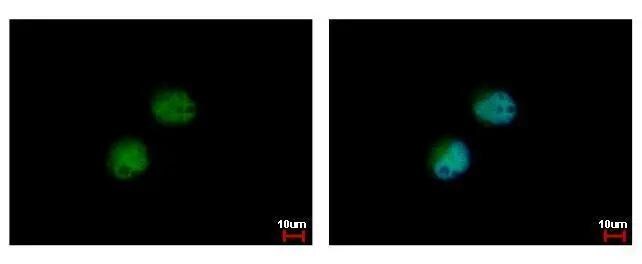 PRMT7 Antibody