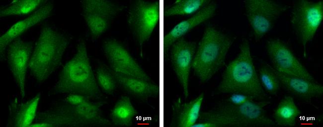 S5a/Angiocidin Antibody - BSA Free