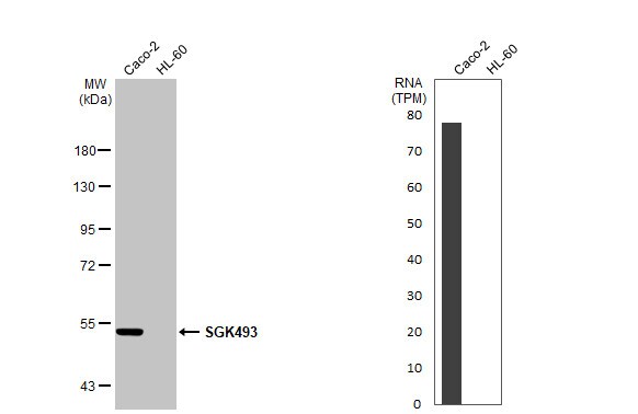 Protein kinase-like protein SgK493 Antibody