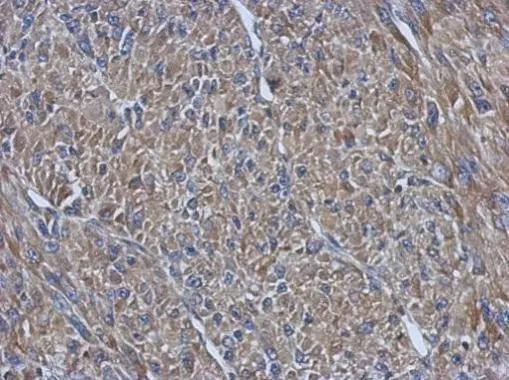 PRPSAP2 Antibody