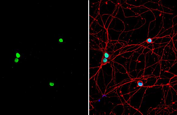 PUM2 Antibody - BSA Free