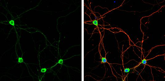 PUM1 Antibody