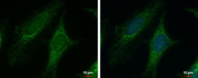 PYCR1 Antibody - BSA Free