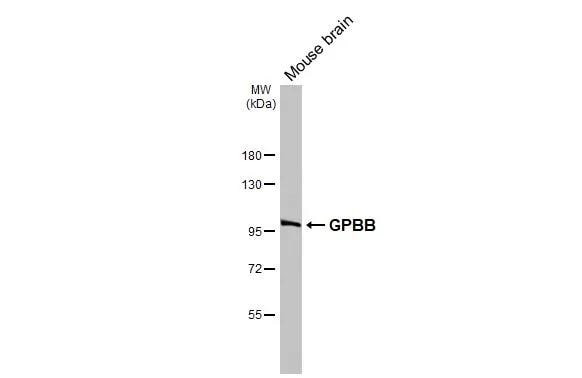 Glycogen Phosphorylase BB/GPBB Antibody - BSA Free