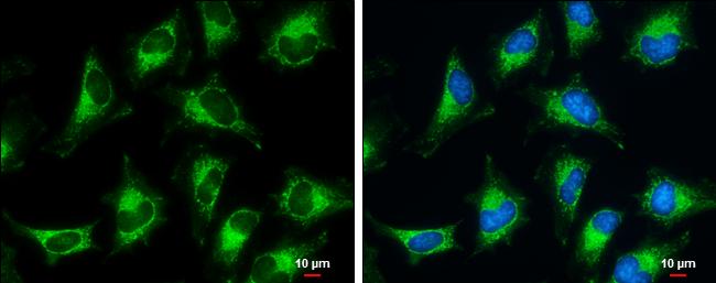 Pyruvate Dehydrogenase E1 beta subunit Antibody