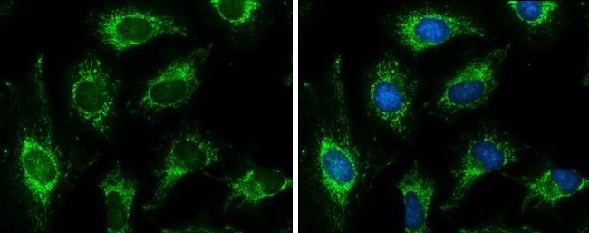 Pyruvate Dehydrogenase E1 beta subunit Antibody