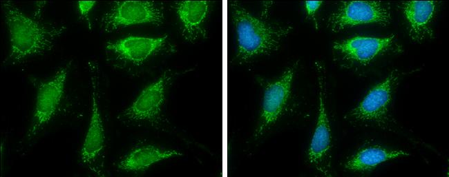 Pyruvate Dehydrogenase E2 Antibody