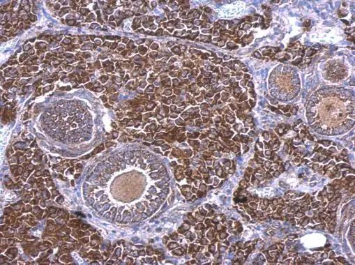 RAB33B Antibody - BSA Free