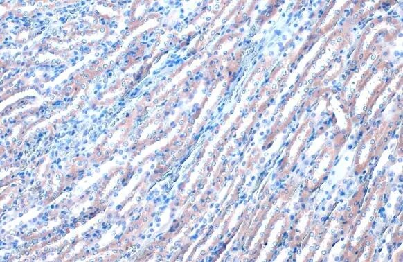 RAB35 Antibody