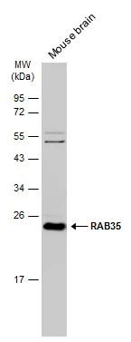 RAB35 Antibody - Azide Free