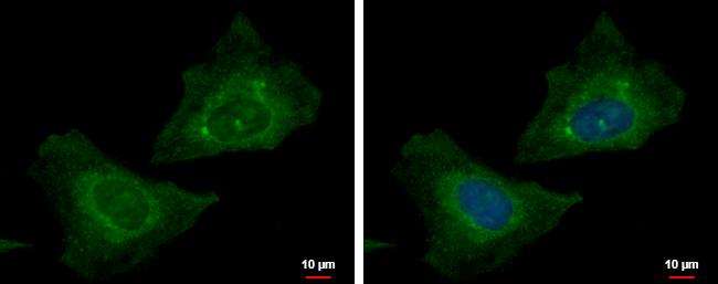 RABGGTB Antibody
