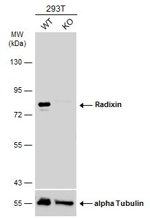 Radixin Antibody