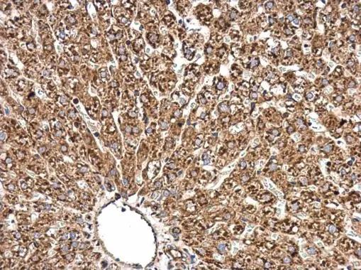 Radixin Antibody