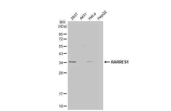 RARRES1 Antibody - BSA Free