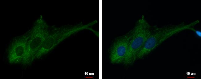 RASA3 Antibody - BSA Free