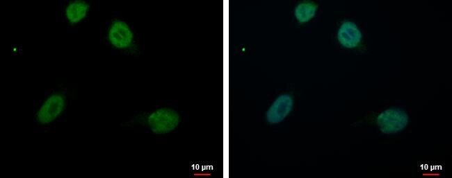 RED Antibody - BSA Free
